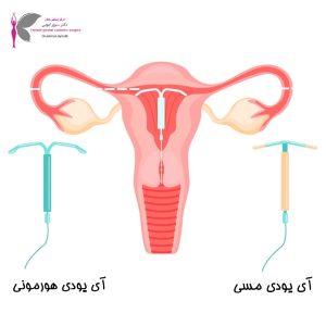 آی یودی- دکتر سرور ایوبی