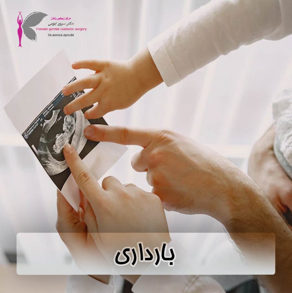 بارداری - دکتر سرور ایوبی