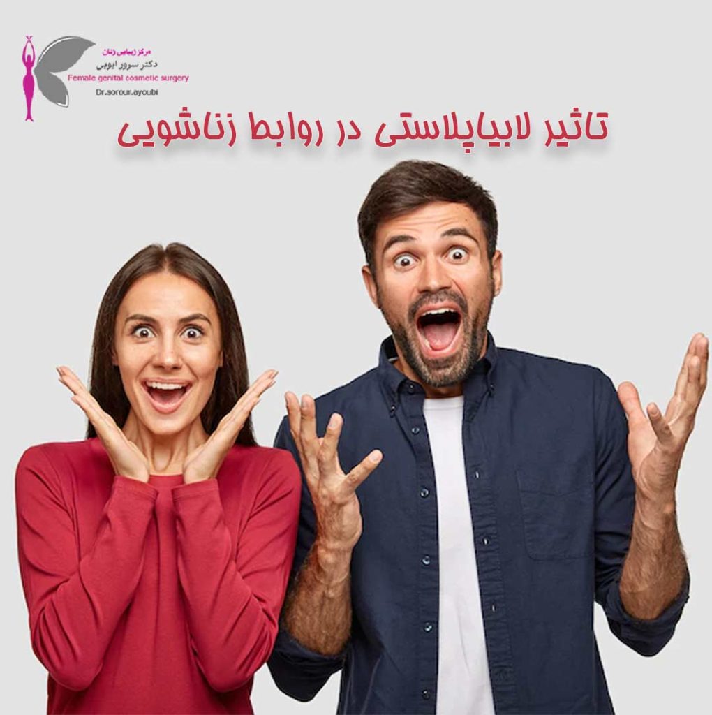 تاثیر لابیاپلاستی در روابط زناشویی - دکتر سرور ایوبی