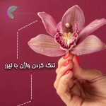 تنگ کردن واژن با لیزر در اهواز