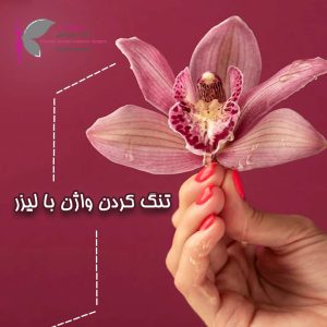 تنگ کردن واژن - دکتر سرور ایوبی