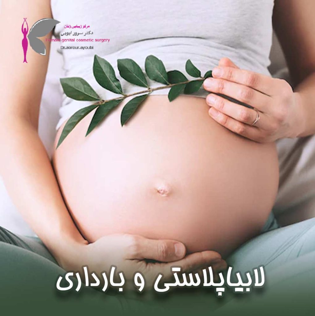 لابیاپلاستی و بارداری - دکتر سرور ایوبی