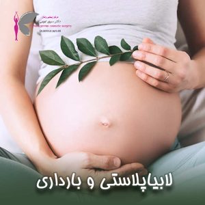لابیاپلاستی و بارداری - دکتر سرور ایوبی