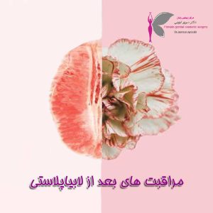 مراقبت های بعد از لابیاپلاستی - دکتر سرور ایوبی