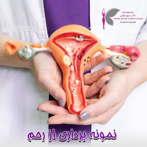 نمونه برداری از رحم - دکتر سرور ایوبی