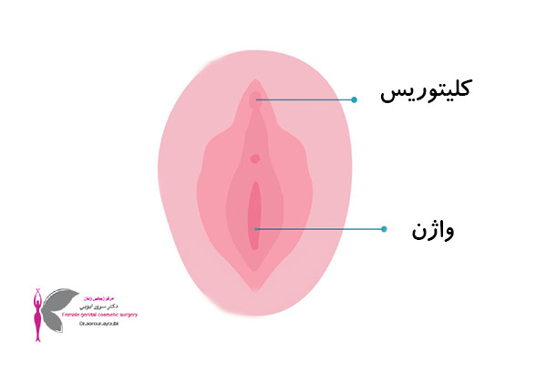 عمل زیبایی کلیتوریس در اهواز - دکتر سرور ایوبی 