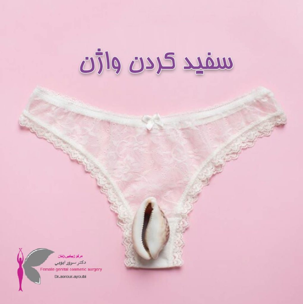 سفید کردن واژن - دکتر سرور ایوبی