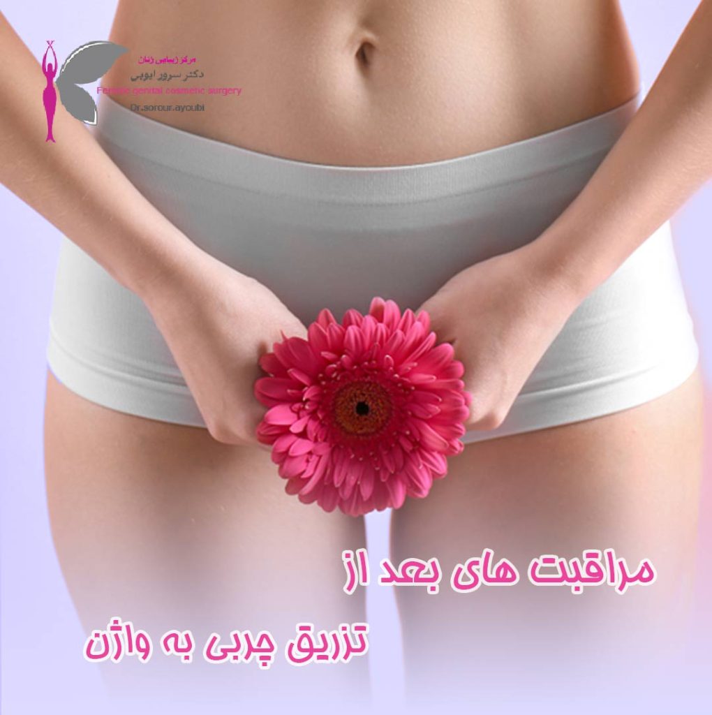 مراقبت های بعد از تزریق چربی - دکتر سرور ایوبی