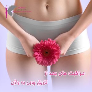مراقبت های بعد از تزریق چربی - دکتر سرور ایوبی