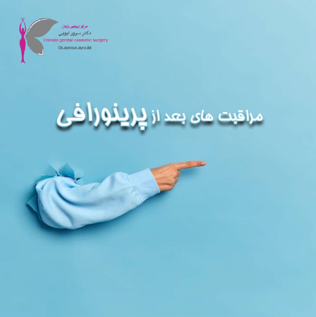 مراقبت های بعد از پرینورافی - دکتر سرور ایوبی