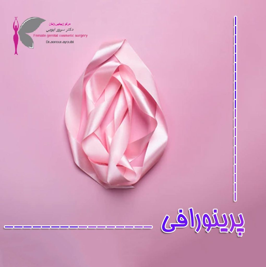 پرینورافی - دکتر سرور ایوبی
