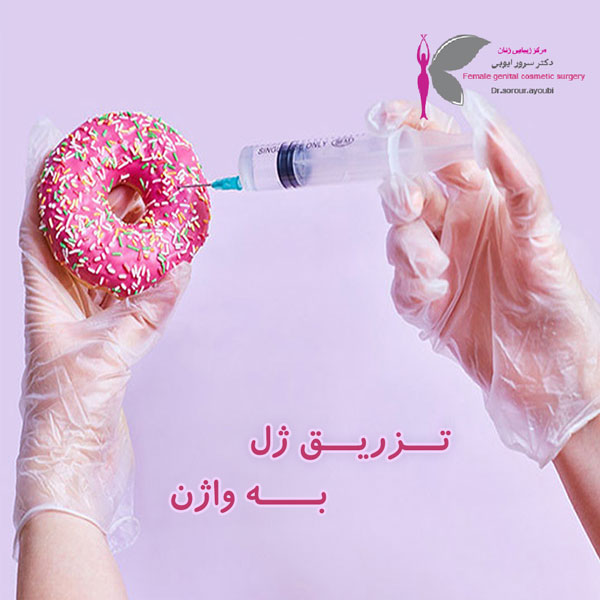 تزریق ژل به واژن در اهواز - دکتز سرور ایوبی