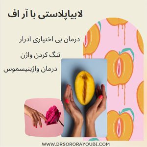 لابیاپلاستی با آر اف - دکتر سرور ایوبی در اهواز
