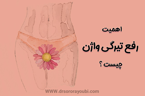سفید کردن واژن در اهواز - دکتر سرور ایوبی 