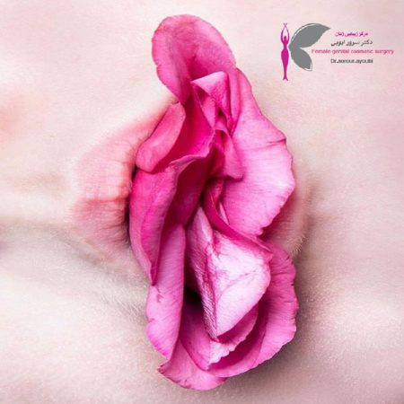 لابیاپلاستی در اهواز - دکتر سرور ایوبی